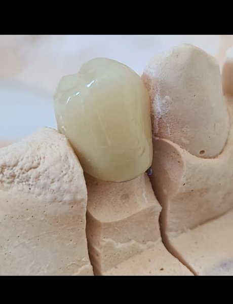 Alveolo Dent - Cabinet stomatologic, Bucuresti