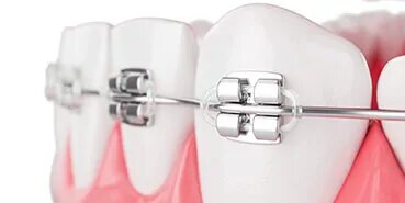 Alveolo Dent - Cabinet stomatologic, Bucuresti