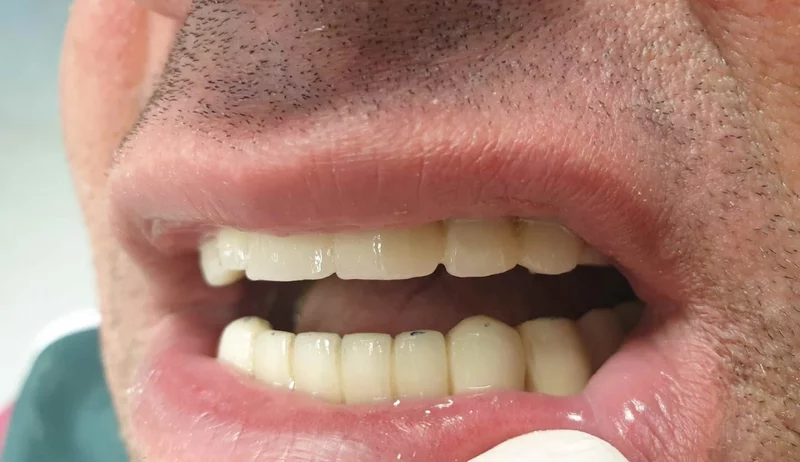 Alveolo Dent - Cabinet stomatologic, Bucuresti